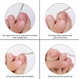 Ensemble d'outils professionnels de podologie et de pédicure en acier inoxydable pour le traitement des ongles incarnés, instruments de soin des ongles par INNOVAMED - Product Image 2
