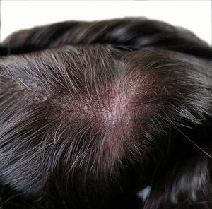 Prothèse Capillaire <span class=keywords><strong>Homme</strong></span> : Perruque en Cheveux Humains, Système de Base en PU Intégral pour Hommes Souffrant de Calvitie, Cheveux Indiens Remy Ondulés, Raides ou Bouclés - Product Image 5