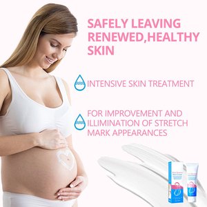 <span class=keywords><strong>Para</strong></span> Aichun Beauty, la <span class=keywords><strong>mejor</strong></span> <span class=keywords><strong>crema</strong></span> <span class=keywords><strong>corporal</strong></span> Natural <span class=keywords><strong>para</strong></span> mujeres <span class=keywords><strong>embarazadas</strong></span>, <span class=keywords><strong>crema</strong></span> hidratante suave <span class=keywords><strong>para</strong></span> eliminar estrías, <span class=keywords><strong>crema</strong></span> anticicatrices - Product Image 3