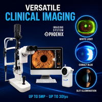 Lámpara de Hendidura LED SL-F5D con Sistema de Imagen Digital para Clínica Oftalmológica, con Reporte de Gestión Avanzada de Pacientes con un Solo Clic
