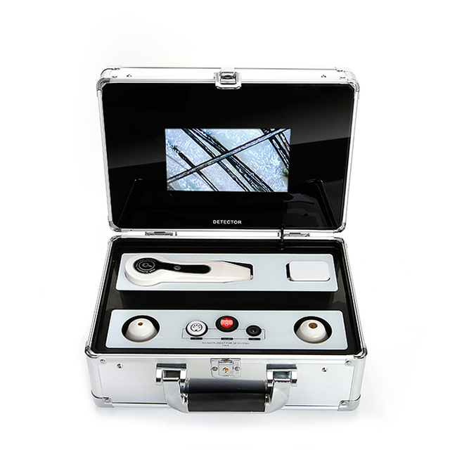 Portable Skin Scope Analysis Equipment Skin Analysis Camera SA-S20A Hair Analyzer