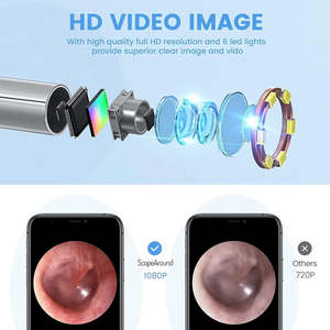 Otoscopio Quirúrgico Portátil Astrin de Acero Inoxidable Manual, Luz de Alto Brillo, Óptica de Precisión para Clínicas, Hospitales y Otorrinolaringología - Product Image 3