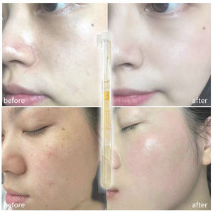 Marque privée OEM Blanchiment des Taches Noires Peau Sèche Méso dermapen Ampoules Microneedling Hydratant Sérum pour le Visage Acide Hyaluronique - Product Image 4