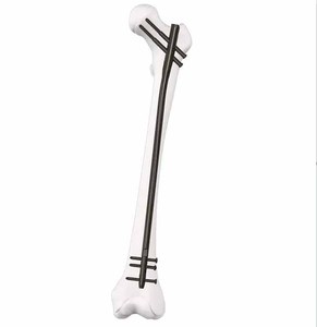 Nieuwste Ontwerp Intramedullaire Nagel Voor Trauma Implantaat <span class=keywords><strong>Titanium</strong></span> Tibiale <span class=keywords><strong>Femur</strong></span> Orthopedische Chirurgische Basis Chirurgische Instrumenten