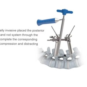 Retractor Tubular de Columna Vertebral, Juego de Instrumentos de Retractor Mínimamente Invasivo para Cirugía de Columna Vertebral, Juegos de Cirugía Ortopédica - Product Image 2