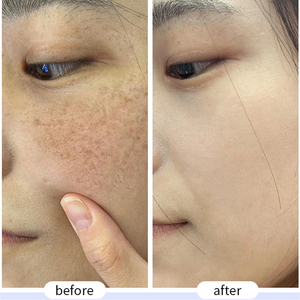 Crema <span class=keywords><strong>Facial</strong></span> 377 de Marca Privada para Eliminar Manchas, Eliminar Pecas, Blanquear e Hidratar - Product Image 5