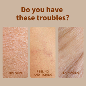 MIDUO fabbrica 500ml di curcuma biologica e acido Kojic lozione per il corpo per macchie scure-pelle luminosa in <span class=keywords><strong>4</strong></span> settimane di lozione per il corpo liscia della pelle - Product Image 6