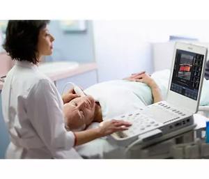 Appareil d'échographie Philips CX30 - Product Image 6