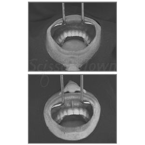 Retractor Labial de Acero Inoxidable para Cirugía Oral, Retracción de Tejidos Blandos y Procedimientos de Expansión de Mejillas - Product Image 6