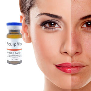 ケミカルピーリング マンデル酸 <span class=keywords><strong>30%</strong></span> AHA アーモンド酸 美容サロン スパ向け 角質除去 ブライトニング 色素沈着治療 - Product Image 1