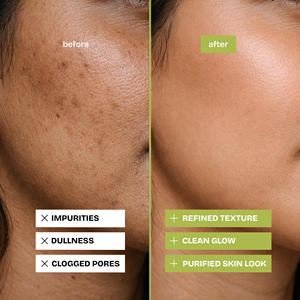 Savon nettoyant en profondeur à la menthe et au concombre pour une peau claire et rafraîchie, enrichi à l'argile de Kaolin pour les soins quotidiens de la peau - Product Image 2