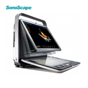 Ecógrafo SonoScape S9 S9V Doppler Color, Máquina de Ultrasonido Portátil, Escáner de Ultrasonido Veterinario - Product Image 1