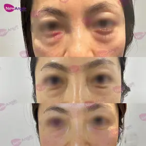 NewangieパルスリフトプロフェッショナルRFEms顔の肌を引き締めるための顔の若返りリフティングマシン