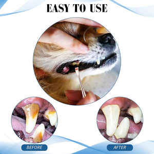 Instrumental Odontológico para Obturaciones, Espátula para Obturaciones de Composite, Juego de Rellenadores con Mango, Juego de Restauración, Instrumental Odontológico para Obturaciones - Product Image 2