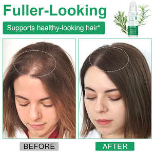 سيروم نمو الشعر سهل الامتصاص من ATOANY بحجم 20 مل مع إكليل الجبل، يعيد تكثيف الشعر ويقوي الجذور، غير دهني - Product Image 3