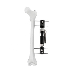 Nuevo Sistema de Fijación Externa de Fémur Médico Profesional de Primera Calidad, Venta Caliente 2025, Juego de Instrumentos Personalizados de 8 mm - Product Image 2