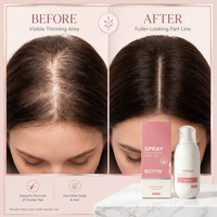 Semprotan Pertumbuhan Rambut Biotin 5% Formula Terkonsentrasi Ekstrak Tumbuhan Alami untuk Rambut Sehat OEM Label Pribadi