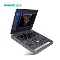 SonoScape - Sistema de Ultrasonido Doppler Color Digital Portátil X5 X5V con una Sonda, para Clínica, Hospital, Animales Pequeños y Equinos