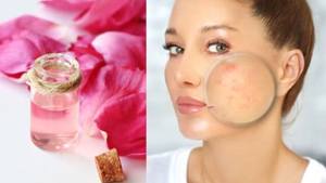 Eau de rose biologique de marque privée Brume pour le visage Spray de soin de la peau hydratant Tonique pour le visage Eau de rose - Product Image 3