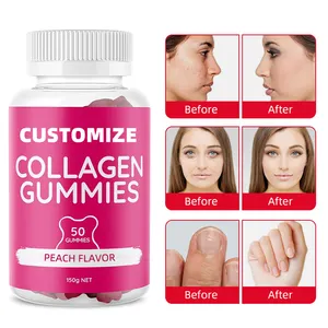 Op Maat Gemaakte Whitening Collageen Gummies Voor Volwassenen Tieners Kinderen Biotine Vitamine C Supplement Gummy Candy