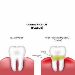 Raspador Dental Manual Personalizado de Alta Calidad, Mango Hueco de Acero Inoxidable, Superficie Pulida, Certificado CE, Garantía de 3 Años para Uso Dental - Product Image 2