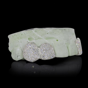 Grilles dentaires personnalisées en or massif serties de diamants de moissanite VVS, style hip-hop, avec un motif en zigzag - Product Image 2