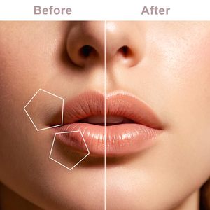 Afeitadora Facial Eléctrica Impermeable IPX7 para Mujer, Maquinilla de Afeitar Facial de Una Sola Cuchilla para Labios y Barbilla - Product Image 5