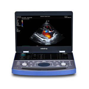 Ecógrafo Veterinario Portátil Mindray Vetus E7 con Doppler Color - Product Image 1