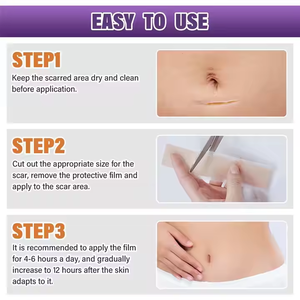 Échantillon gratuit de produits de soin de la peau pour l'élimination des cicatrices d'acné, traitement des cicatrices, gel, ruban adhésif pour les cicatrices - Product Image 6