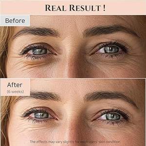 Sérum crème pour les yeux léger personnalisé formule hydratante à l'acide hyaluronique à absorption rapide pour la réduction du sac sous les yeux - Product Image 3