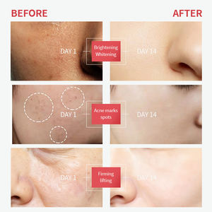 OEM özelleştirilmiş cilt bakım ürünleri Retinol + c vitamini antioksidan anti-kırışıklık nemlendirici canlandırıcı yüz serumu - Product Image 5