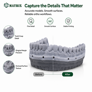 Resina de Modelo Ortho Lavable con Agua Matrix para Impresoras DLP LCD de 405nm con Alta Precisión y Salida Estable para Modelos de Laboratorio Dental - Product Image 3