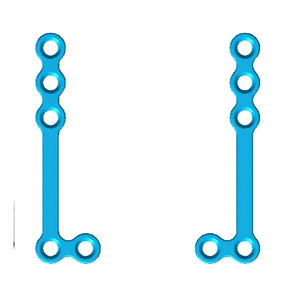 Implante Maxilofacial de Alta Calidad Tipo Z, Implante Confiable para Reconstrucción Facial, Implantes Quirúrgicos Ortopédicos Veterinarios - Product Image 1
