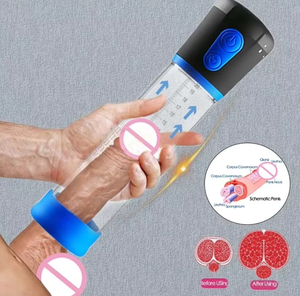 Bomba de Alargamiento de Pene Masculina de Alta Calidad, Instrumento Quirúrgico para la Mejora del Pene, Gran Venta - Product Image 2