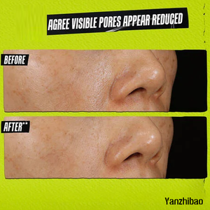 Mascarilla Facial de Arcilla con Niacinamida de Tierras Raras OEM, Minimiza los Poros, Limpieza Profunda y Beneficios Refinadores de Poros para Todo Tipo de Piel - Product Image 5