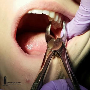 Kit de pinces d'extraction dentaires manuelles de haute qualité de 12 pièces Instruments chirurgicaux dentaires pour la chirurgie - Product Image 5