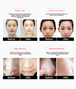 Appareil de beauté pour le visage, oxygène, nettoyage en profondeur de la peau, soin de la peau sans aiguille, rajeunissement de la peau, traitement facial - Product Image 3