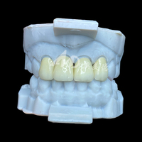 Couronne en zircone de porcelaine E-max à externaliser |   Restaurations dentaires de précision avec technologie E-max et zircone
