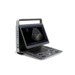 Système d'échographie diagnostique portable A6V Expert-E1V de qualité supérieure - Product Image 1