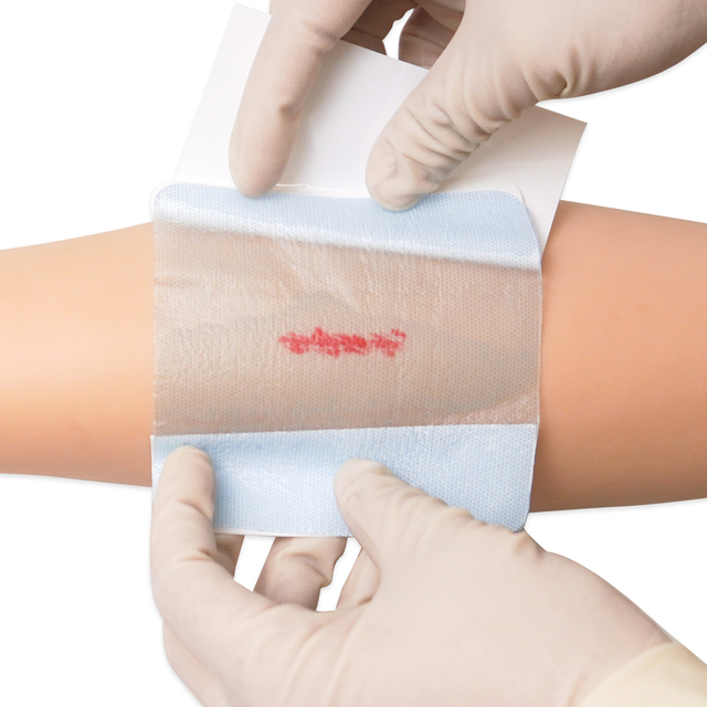 Medical Hydrogel Wound Dressing with Super Absorbent Advance Film Waterproof Dressing for Burn Care