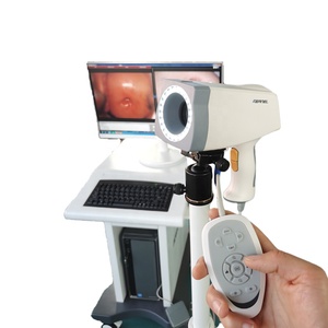 <span class=keywords><strong>Ce</strong></span> được phê duyệt hạt nhân KN 2200 xách tay video kỹ thuật số soi cổ tử cung cho phụ khoa âm đạo kiểm tra - Product Image 6