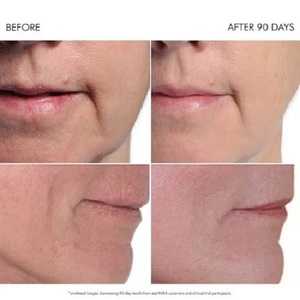 Nuevo Láser de Precisión Original Personalizable de Grado Industrial y para Bricolaje, Compatible con OEM/ODM/OBM, Garantía de 3 Años, Origen Estadounidense - Product Image 3