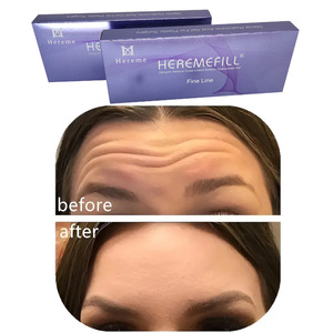 Hereme Effet Longue Durée 100% <span class=keywords><strong>Acide</strong></span> <span class=keywords><strong>Hyaluronique</strong></span> Stérile Réticulé pour le Visage et les Lèvres 1ml 2ml 10ml - Product Image 1