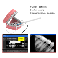 Sensor de Imagenología Dental Profesional para Clínicas Dentales, Sistema de Sensor de Imagen Nítida, Equipo para Dentistas, Sensor ECO
