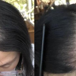 Olio e Crema Organici Lustrao per la Ricrescita dei Capelli con Olio di Ricino per Capelli Danneggiati, Ricci e Secchi - Spray Nutriente per Capelli - Product Image 3