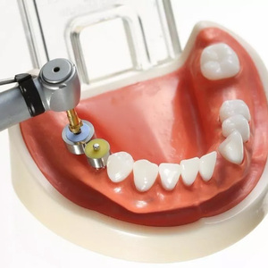 Juego completo de implantes dentales: SSG3 + guía de perforación de implante Y + marcador de implante Y - Product Image 5