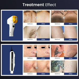 Perfectlaser Machine laser 2 en 1 diode et picoseconde 755nm 808nm 1064nm Nd Yag pour l'élimination des tatouages et l'épilation au laser diode - Product Image 4