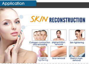 ADSS tıbbi CE fraksiyonel Co2 lazer vajinal sıkma makinesi lazer cilt yenileme anti-aging kırışıklık kaldırma - Product Image 6