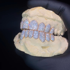 Hip Hop personalizado 925 dientes de plata Grillz Iced Out Moissanite diamante Grillz dientes joyería de plata mejor precio - Product Image 1