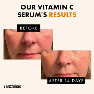 Oem סרום נוגד חמצון רב עוצמה עם ויטמין <span class=keywords><strong>c</strong></span> אנטי אייג 'ינג להאיר עור עמום ולהפחית כתמים כהים - Product Image 2